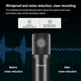 PULUZ Microfono a condensatore Studio Broadcast Kit microfono professionale p...